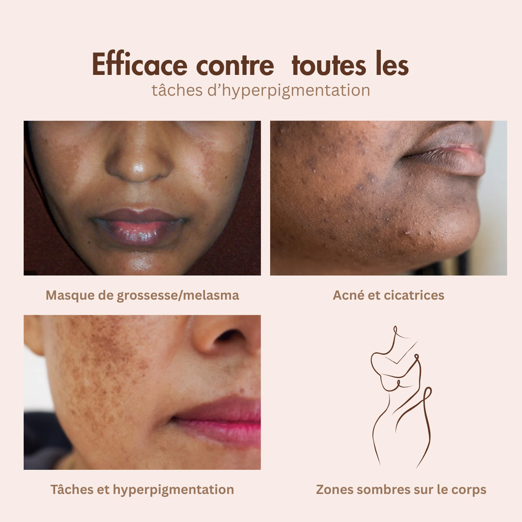 Crème anti tâches - spéciale peaux mattes